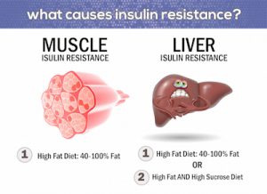 muscle-liver-insulin-resistance